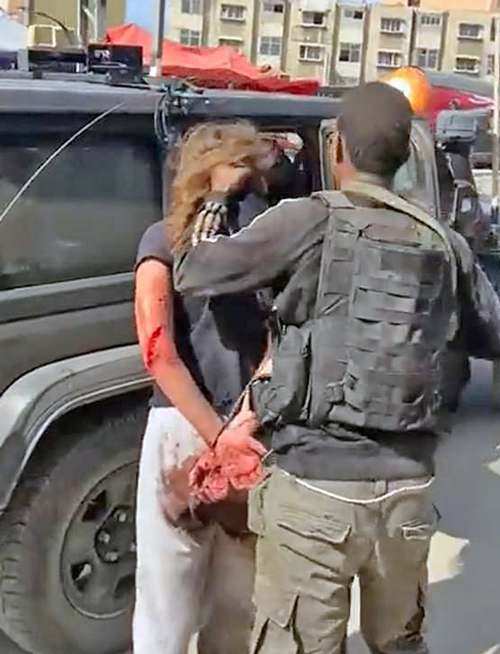 During Oct. 7 massacre, Hamas terrorist pulls hair of young Israeli woman, bloodied, with hands tied behind her back, forcing her into a car. Many women were raped and disfigured, then taken as hostages.